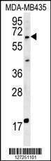 Anti-MKRN3 Rabbit Polyclonal Antibody (APC (Allophycocyanin))