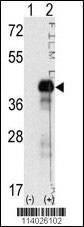 Anti-SOX2 Rabbit Polyclonal Antibody