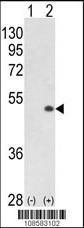 Anti-CDK16 Rabbit Polyclonal Antibody (PE (Phycoerythrin))