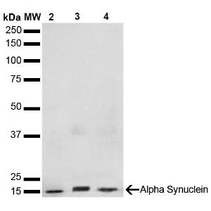 Western blot analysis of Human, mouse, rat brain showing detection of 14 kDa Alpha Synuclein protein using Anti-alpha Synuclein Antibody [3F8] (A304961) at 1:1,000 for 2 hours at room temperature