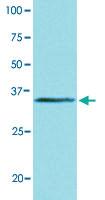 Anti-BRCC3 Mouse Monoclonal Antibody [clone: AT3B1]