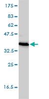 Anti-TEX264 Mouse Monoclonal Antibody [clone: 2A3-1A10]