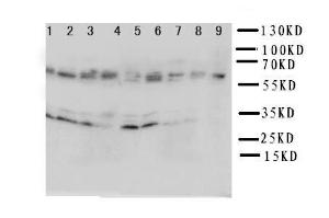 Anti-IL5RA Rabbit Polyclonal Antibody