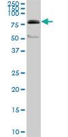 Anti-PRDM1 Mouse Monoclonal Antibody [clone: 1G9]