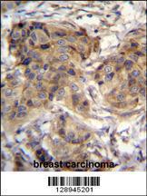 Anti-TTC9C Rabbit Polyclonal Antibody (FITC (Fluorescein Isothiocyanate))