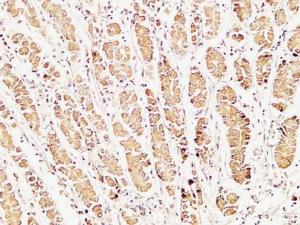 Anti-pro Caspase1 + p10 + p12 Rabbit Polyclonal Antibody