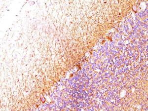 Immunohistochemical analysis of formalin-fixed, paraffin-embedded cerebellum using Anti-NF-L Antibody [SPM204]