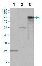 Anti-MPO Mouse Monoclonal Antibody [clone: 9B12G7,4D8B12,9B12D9,9C11A5]