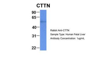 Anti-CTTN Rabbit Polyclonal Antibody