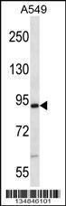 Anti-NEK4 Rabbit Polyclonal Antibody (APC (Allophycocyanin))