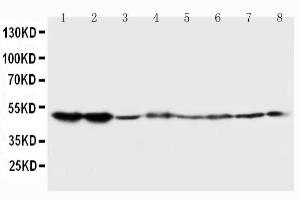 Anti-5HT2A Receptor Rabbit Polyclonal Antibody