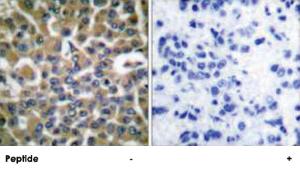 Anti-EEF2 Rabbit Polyclonal Antibody