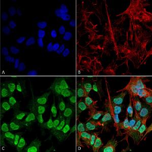 Immunocytochemistry/Immunofluorescence analysis of human neuroblastoma cell line (SK-N-BE, fixed in 4% formaldehyde for 15 min at room temperature, using Anti-alpha Synuclein Antibody [3F8] (A304961), at 1:100 for 60 minutes at room temperature