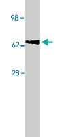 Anti-AFP Mouse Monoclonal Antibody [clone: C3]