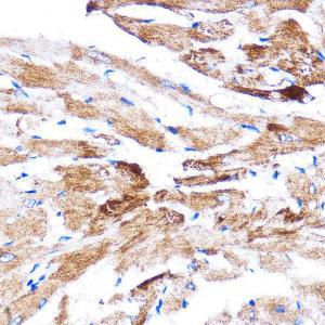 Immunohistochemistry analysis of paraffin-embedded rat heart using Anti-HSPB7 Antibody (A307784) at a dilution of 1:100 (40X lens). Perform microwave antigen retrieval with 10 mM PBS buffer pH 7.2 before commencing with IHC staining protocol