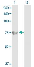 Anti-ACOX1 Rabbit Polyclonal Antibody