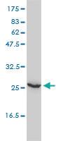 Anti-UBE2T Mouse Monoclonal Antibody [clone: 1E12-4A3]