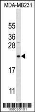 Anti-PTRH2 Rabbit Polyclonal Antibody (Biotin)