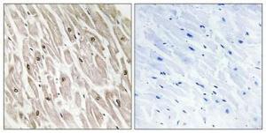 Immunohistochemical analysis of paraffin-embedded human heart using Anti-CLK4 Antibody 1:100 (4°C overnight). The right hand panel represents a negative control, where the antibody was pre-incubated with the immunising peptide.