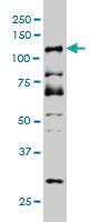 Anti-DMTF1 Mouse Monoclonal Antibody [clone: 5C6]