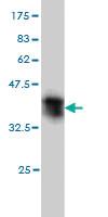 Anti-ST3GAL2 Mouse Monoclonal Antibody [clone: 1E12]