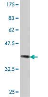 Anti-MTHFD1L Mouse Polyclonal Antibody