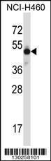 Anti-MKX Rabbit Polyclonal Antibody (APC (Allophycocyanin))