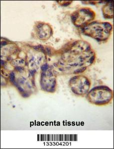 Anti-PTPN2 Rabbit Polyclonal Antibody (FITC (Fluorescein Isothiocyanate))