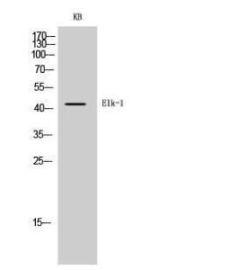 Antibody anti-ELK1 A95371-100 100 µg