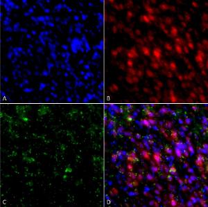 Immunocytochemistry/Immunofluorescence analysis of rat primary hippocampal neurons treated with active alpha synuclein protein aggregate (SPR-322) at 4 µg/ml to induce fibrils, fixed in 4% paraformaldehyde, using Anti-alpha Synuclein Antibody [4F1] (A304962), at 1:200 for 24 hours at 4°C