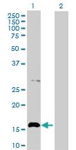 Anti-ACP1 Rabbit Polyclonal Antibody