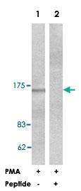 Anti-PLCB3 Rabbit Polyclonal Antibody