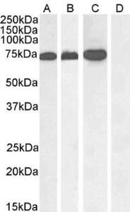 Anti-RACGAP1 Antibody (A83070) (1µg/ml) staining of A431 nuclear (A), Jurkat (B), Jurkat nuclear (C) and negative control Human Pancreas (D) lysate. (35µg protein in RIPA buffer) Detected by chemiluminescence.