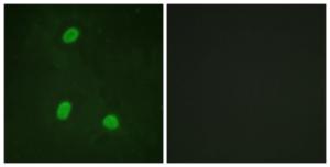 Immunofluorescence analysis of HeLa cells using Anti-NIPA Antibody The right hand panel represents a negative control, where the antibody was pre-incubated with the immunising peptide