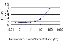 Anti-EBF1 Mouse Monoclonal Antibody [clone: 1G8]