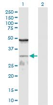 Anti-WDR61 Rabbit Polyclonal Antibody