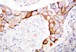 Anti-CD18 Rabbit Polyclonal Antibody