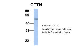 Anti-CTTN Rabbit Polyclonal Antibody