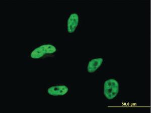 Anti-HOXA9 Mouse Monoclonal Antibody [clone: 2A11-2D2]