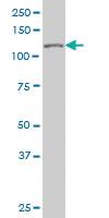 Anti-TP53BP2 Mouse Monoclonal Antibody [clone: 3F8]