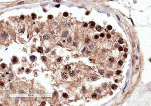 Anti-RACGAP1 Antibody (A83070) (4µg/ml) staining of paraffin embedded Human Testis. Microwaved antigen retrieval with Tris/EDTA buffer pH9, HRP-staining.