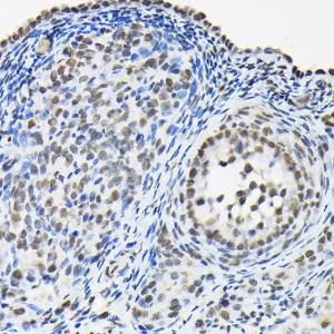 Immunohistochemistry analysis of paraffin-embedded rat ovary using Anti-HNRNPA3 Antibody (A309027) at a dilution of 1:100 (40X lens). Perform high pressure antigen retrieval with 10 mM citrate buffer pH 6.0 before commencing with IHC staining protocol