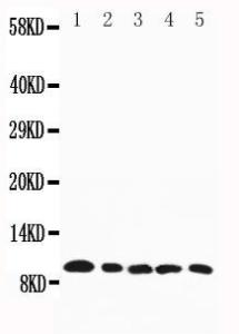 Anti-Macrophage Inflammatory Protein 1 beta Rabbit Polyclonal Antibody