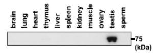 Anti-PDILT antibody