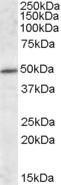 Anti-IFT57 Antibody (A84663) (1 µg/ml) staining of Mouse Brain lysate (35 µg protein in RIPA buffer). Primary incubation was 1 hour. Detected by chemiluminescence