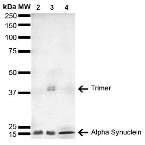 Western blot analysis of Human, mouse, rat brain showing detection of 14 kDa Alpha Synuclein protein using Anti-alpha Synuclein Antibody [4F1] (A304962) at 1:1,000 for 2 hours at room temperature