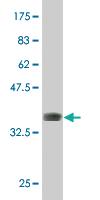 Anti-DLX5 Mouse Monoclonal Antibody [clone: 4B7]