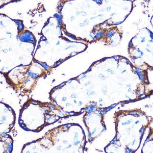 Immunohistochemistry analysis of paraffin-embedded human placenta using Anti-HSPB7 Antibody (A307784) at a dilution of 1:100 (40X lens). Perform microwave antigen retrieval with 10 mM PBS buffer pH 7.2 before commencing with IHC staining protocol