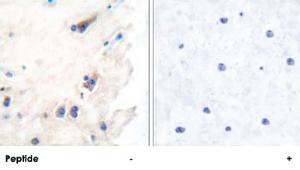 Anti-PLCB3 Rabbit Polyclonal Antibody