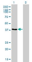 Anti-RNF14 Mouse Monoclonal Antibody [clone: 4G9]